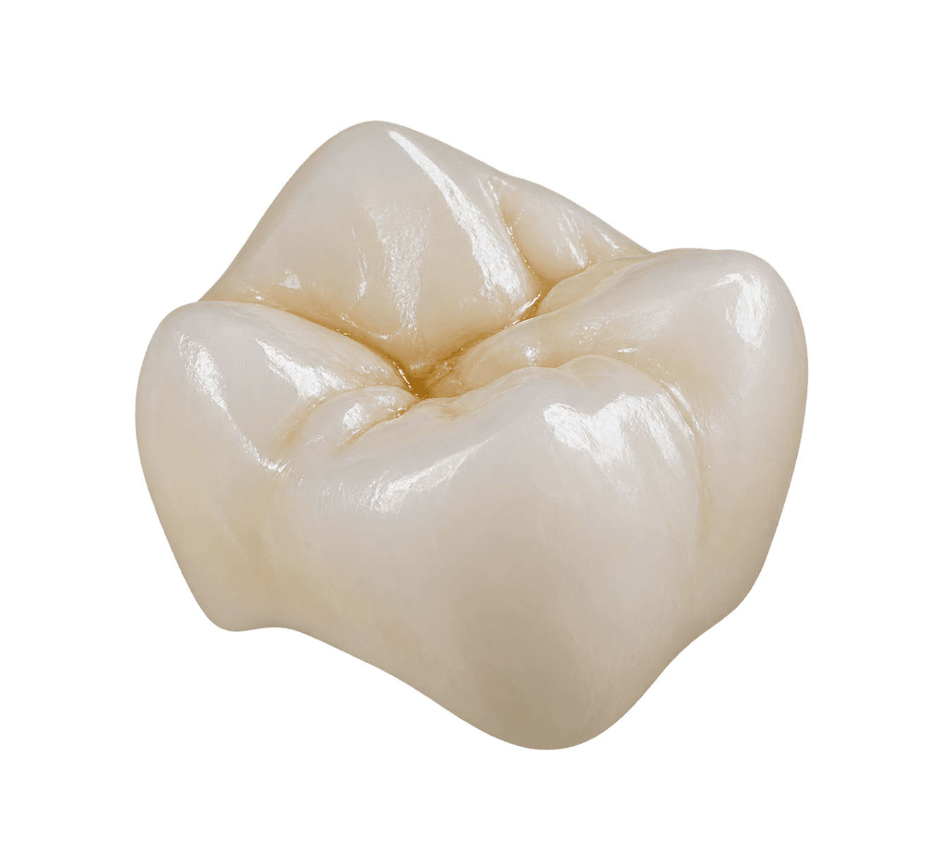 Full-contour zirconia dental restoration