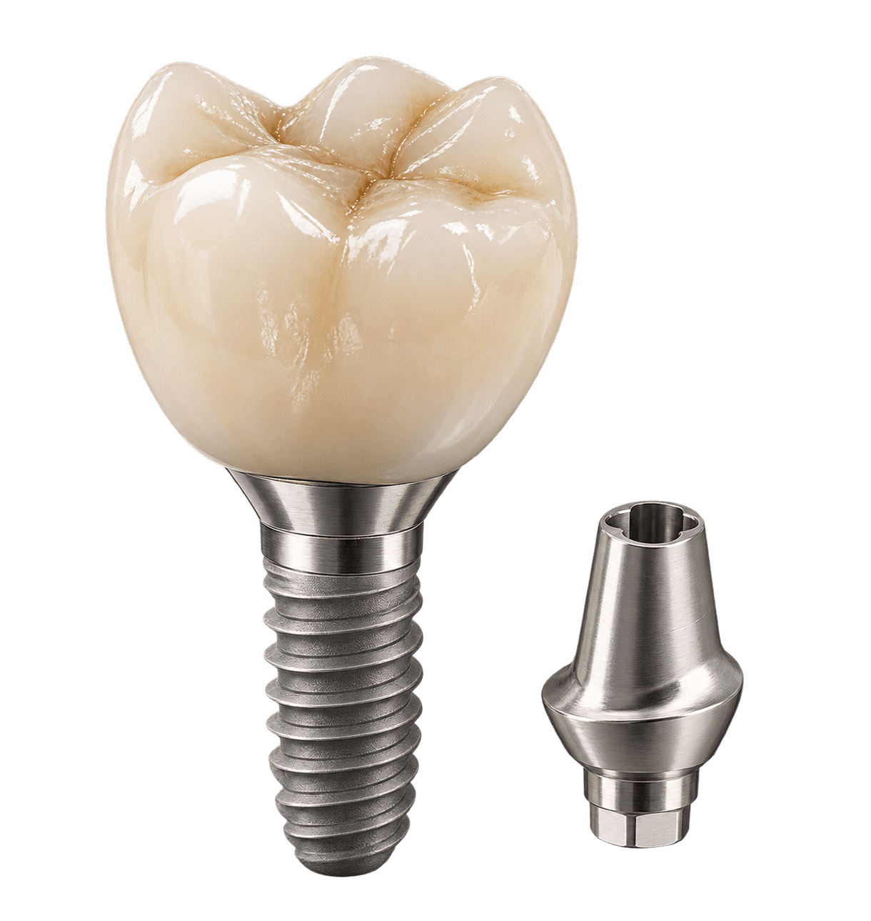 Posterior all-inclusive implant restoration package